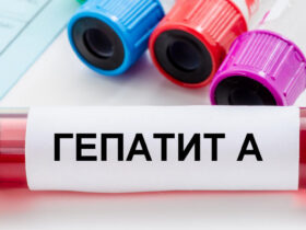 гепатит А
