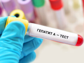 гепатит А