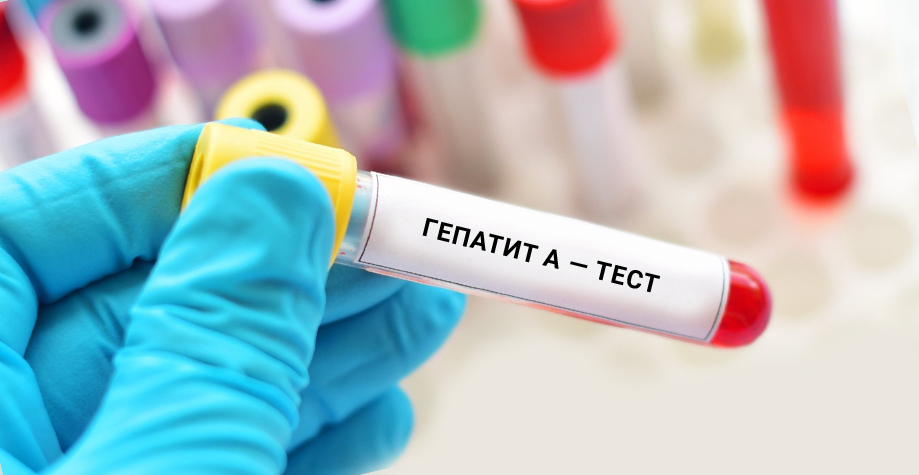 гепатит А