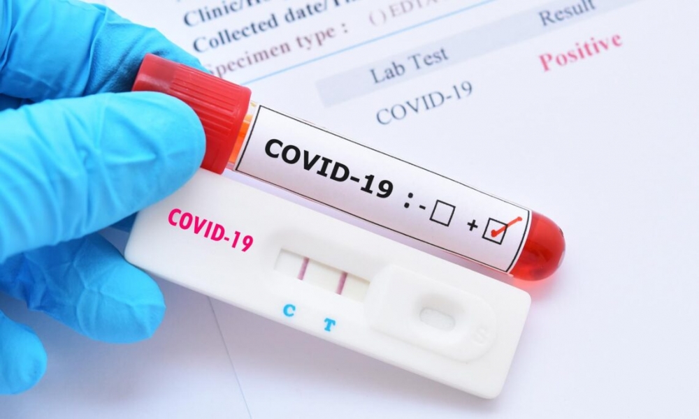 COVID-19