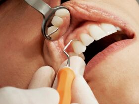 зуби, обличчя