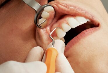 зуби, обличчя