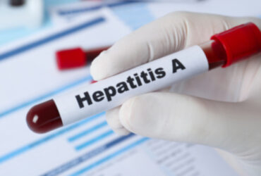 рука, пробірка