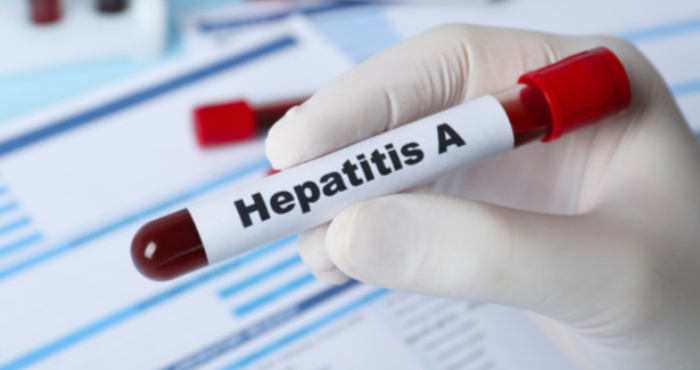 рука, пробірка