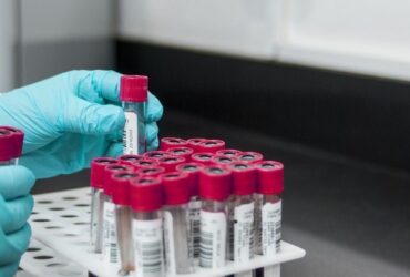 руки, пробірки