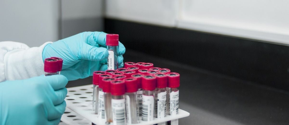 руки, пробірки