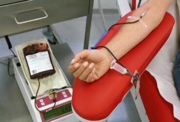 рука, донор