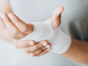 опік дитини